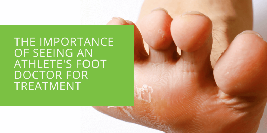 The Importance of Seeing an Athlete's Foot Doctor for Treatment