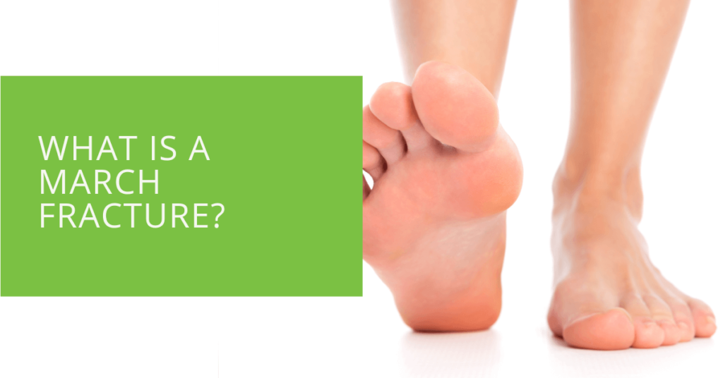What is a March Fracture