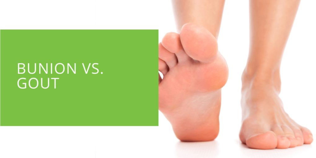 Bunion vs. Gout