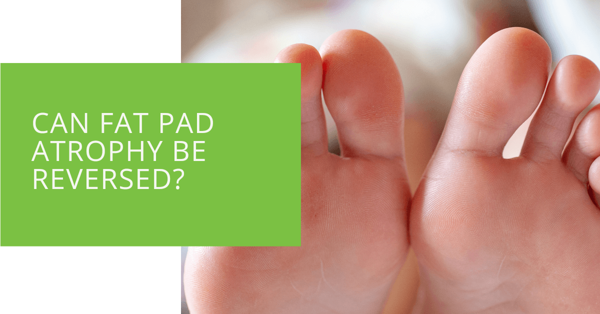 Orthotics Help in Fat Pad Atrophy Treatment – Ergonx