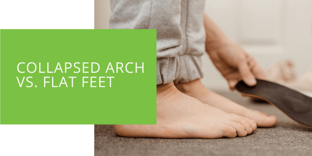 Collapsed Arch vs. Flat Feet