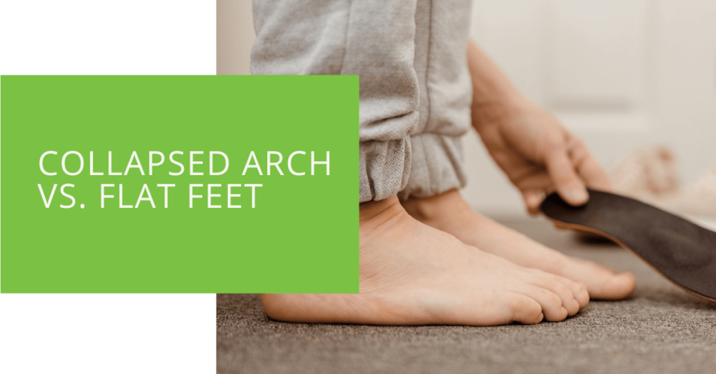 Collapsed Arch vs. Flat Feet