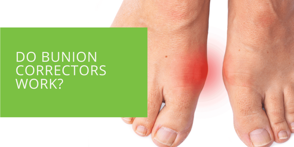 Do Bunion Correctors Work