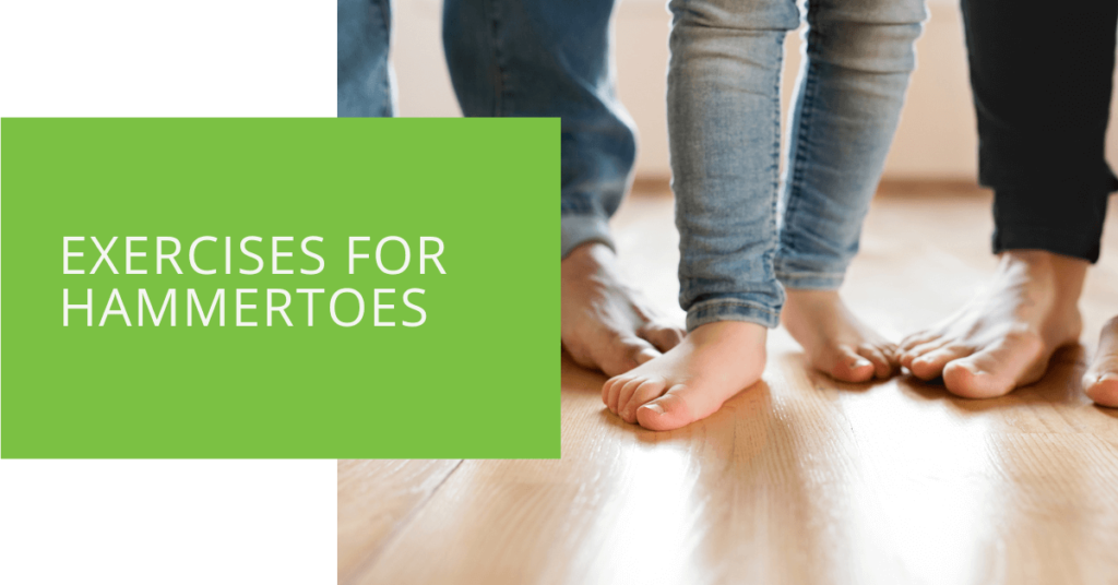 Exercises for Hammertoes