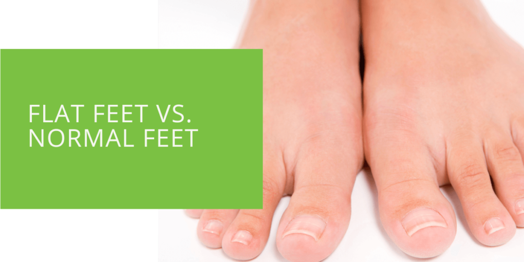 Flat Feet vs. Normal Feet