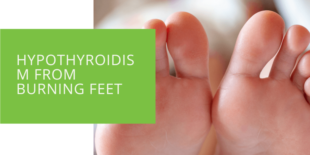Hypothyroidism from Burning Feet