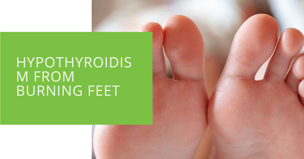 Hypothyroidism from Burning Feet