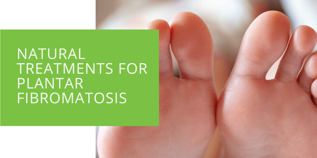 Natural Treatments for Plantar Fibromatosis