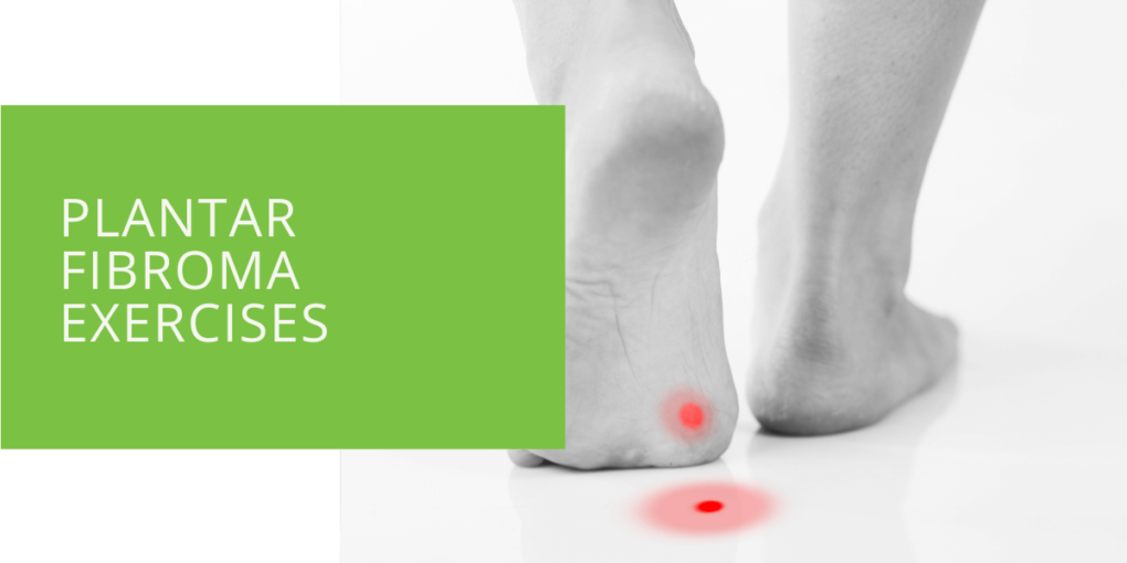 Plantar Fibroma Exercises