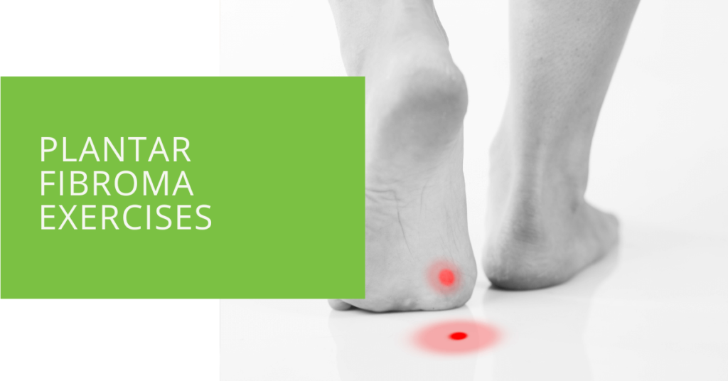 Plantar Fibroma Exercises