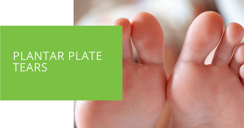 Plantar Plate Tears