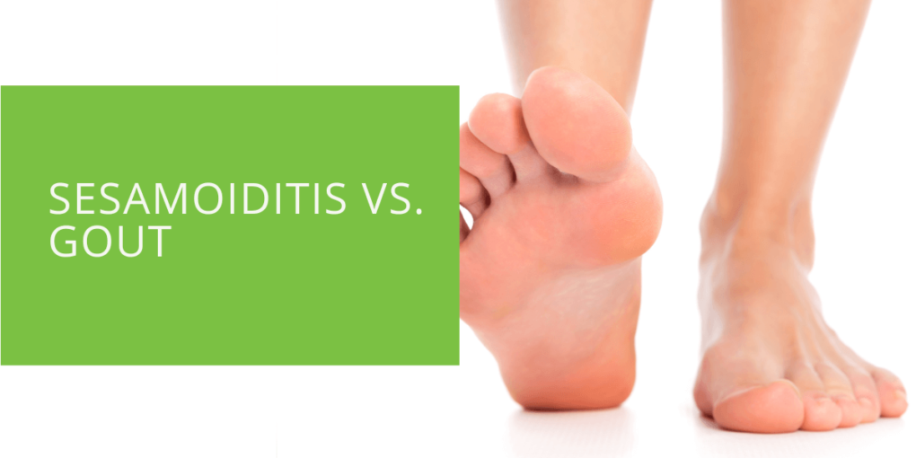 Sesamoiditis vs. Gout