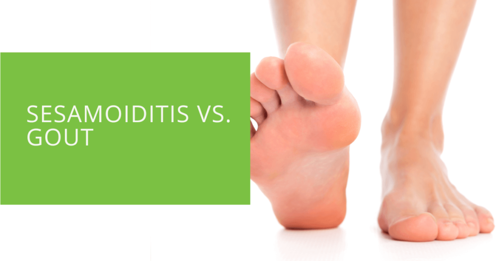 Sesamoiditis vs. Gout