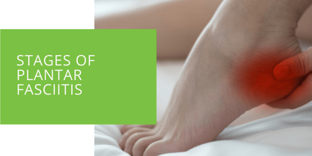 Stages of Plantar Fasciitis