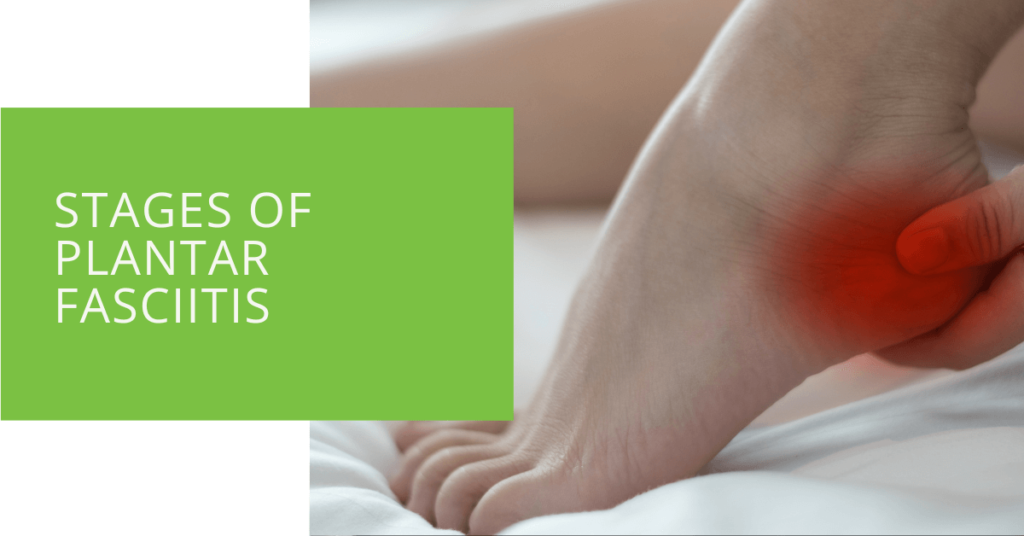 Stages of Plantar Fasciitis