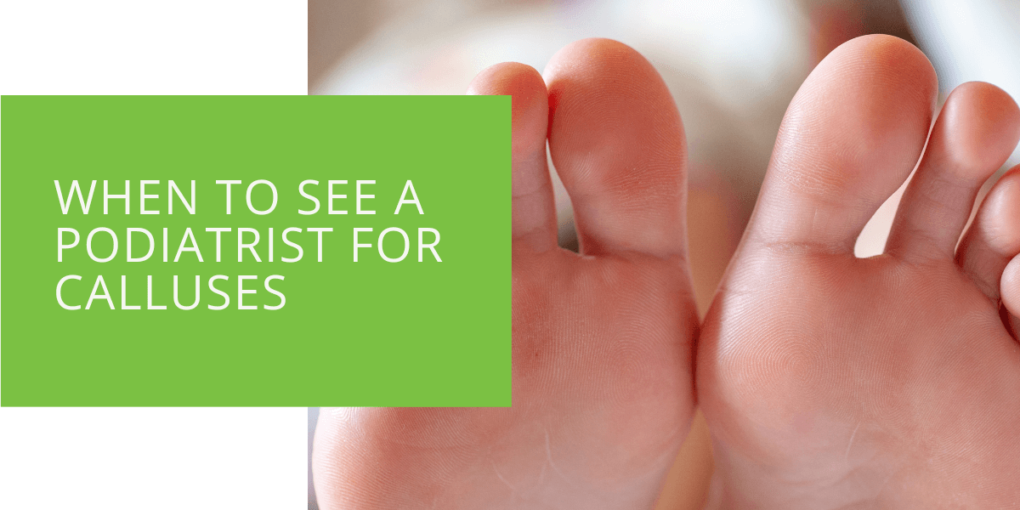 When to See a Podiatrist for Calluses