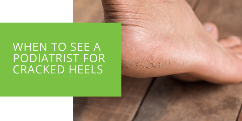 When to See a Podiatrist for Cracked Heels