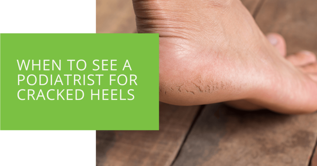 When to See a Podiatrist for Cracked Heels