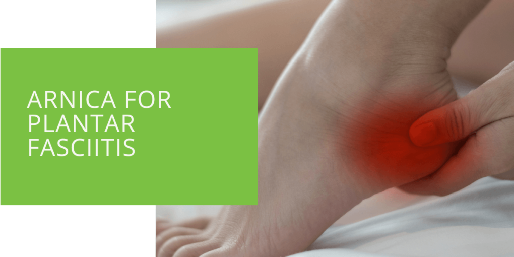 Arnica for Plantar Fasciitis