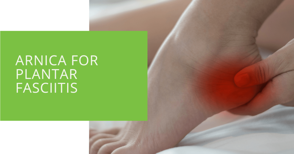 Arnica for Plantar Fasciitis