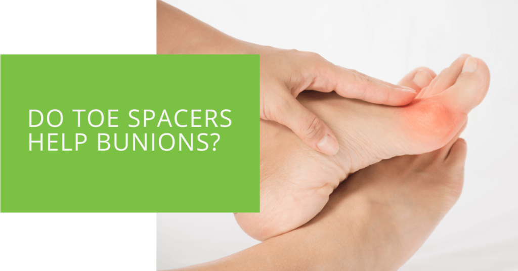 Do Toe Spacers Help Bunions
