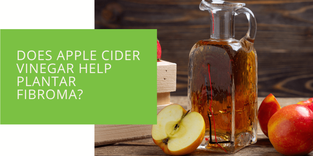 Does Apple Cider Vinegar Help Plantar Fibroma