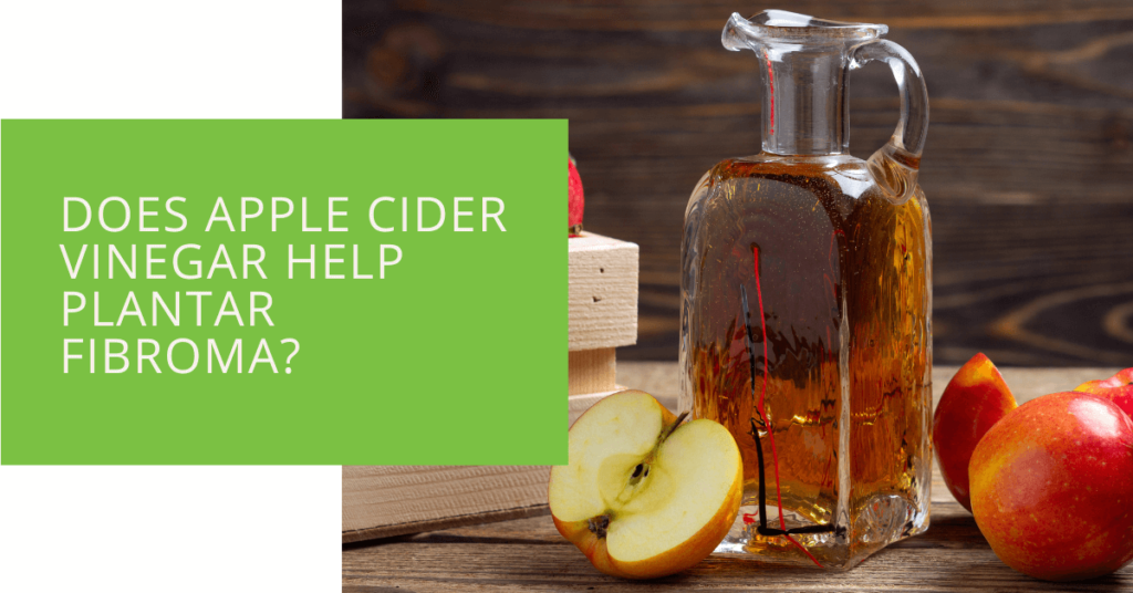 Does Apple Cider Vinegar Help Plantar Fibroma