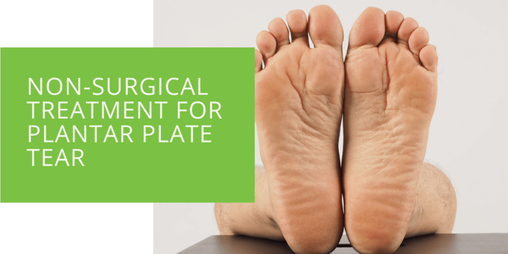 Non-Surgical Treatment for Plantar Plate Tear