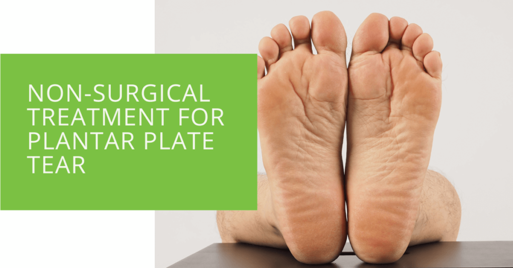 Non-Surgical Treatment for Plantar Plate Tear