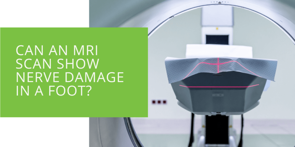 Can an MRI Scan Show Nerve Damage in a Foot