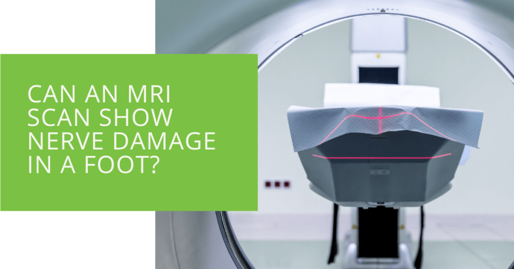 Can an MRI Scan Show Nerve Damage in a Foot