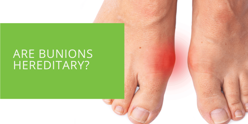 Are Bunions Hereditary