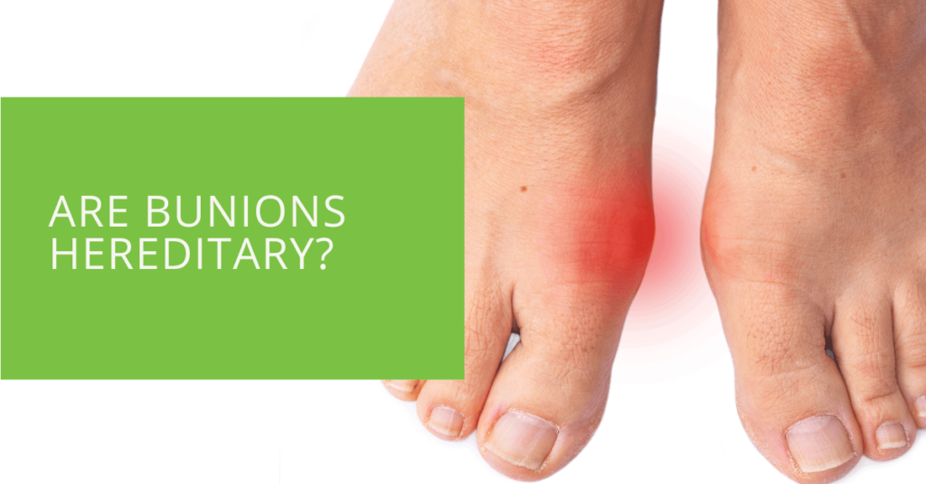 Are Bunions Hereditary