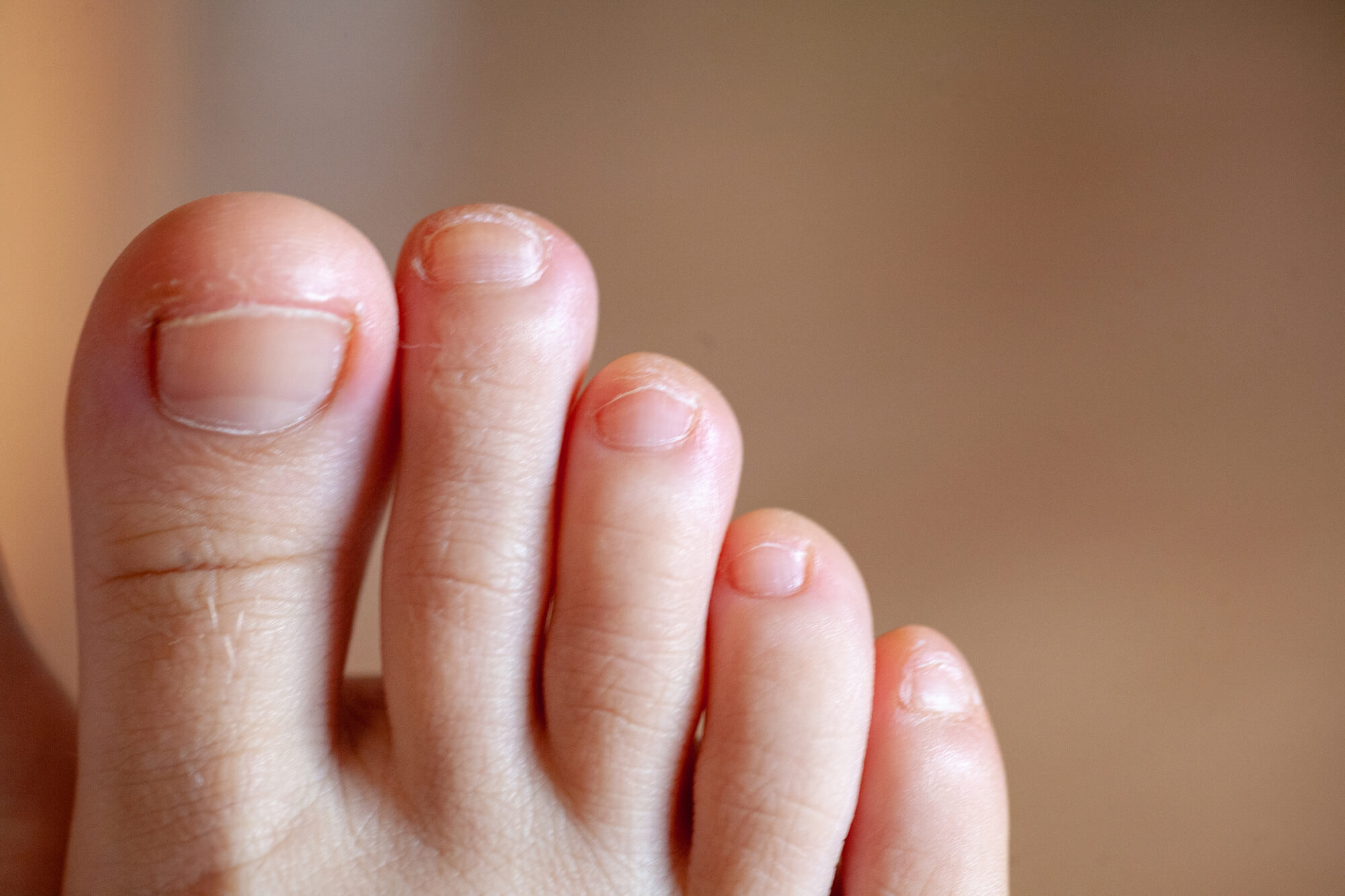 Healthy Toe Nails