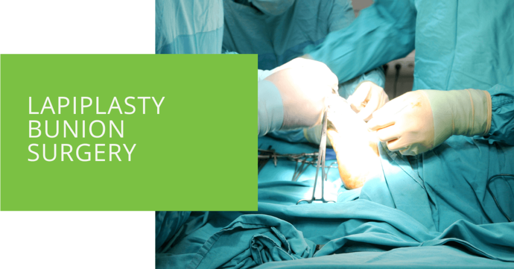 Lapiplasty Bunion Surgery