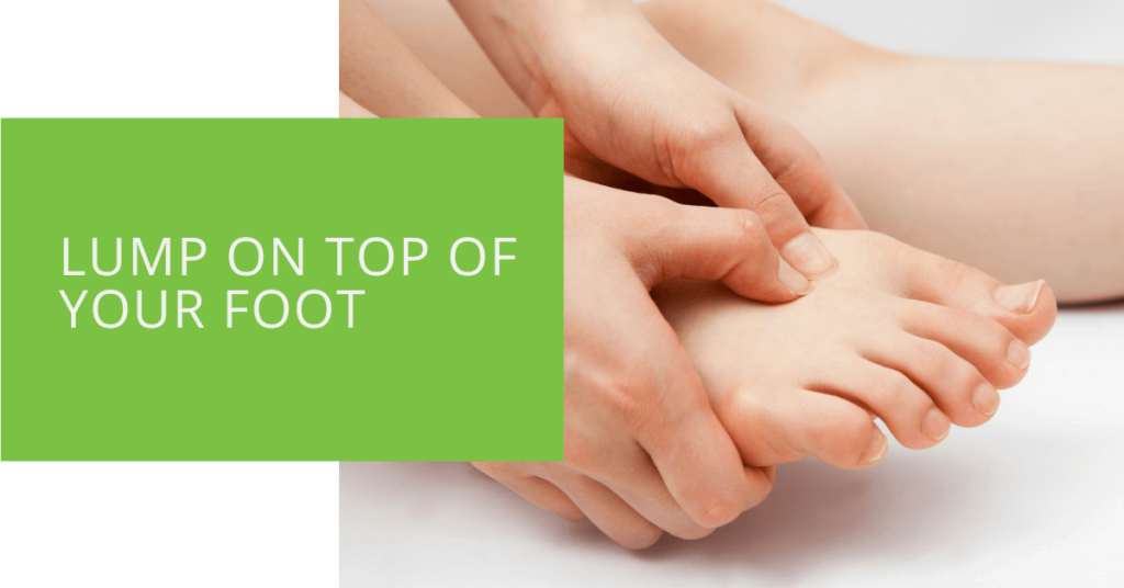 Lump on Top of Your Foot
