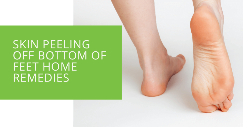 Skin Peeling Off Bottom of Feet Home Remedies