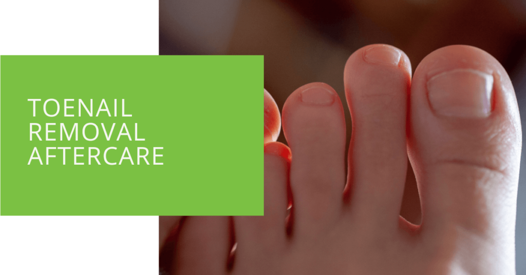 Toenail Removal Aftercare