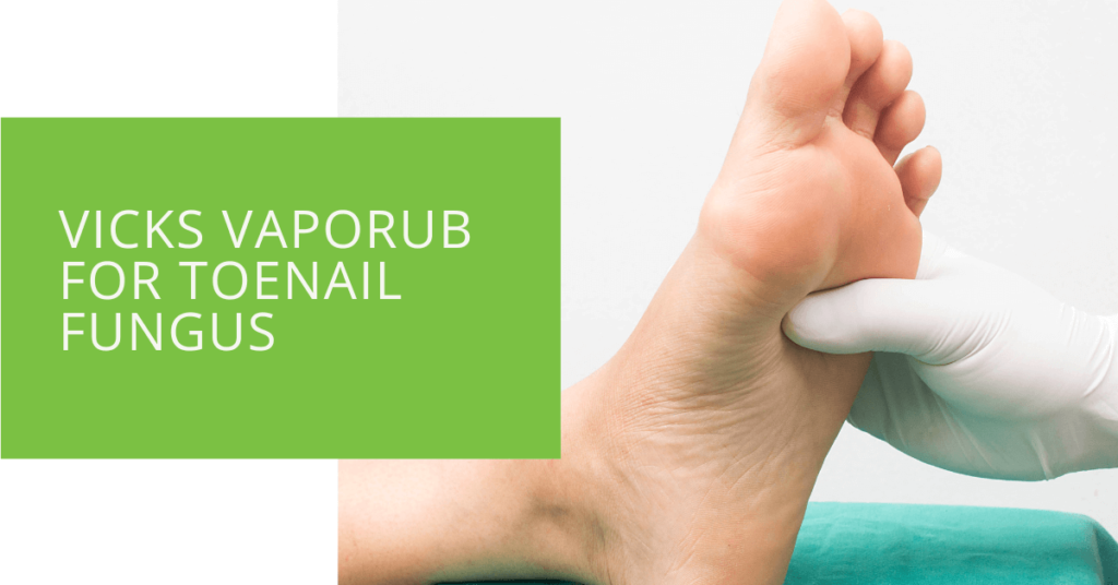 Vicks Vaporub for Toenail Fungus