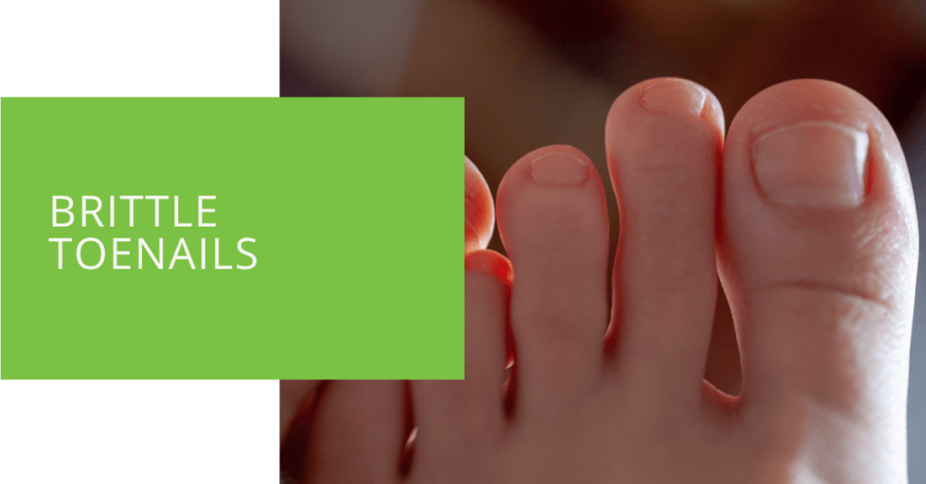 Brittle Toenails