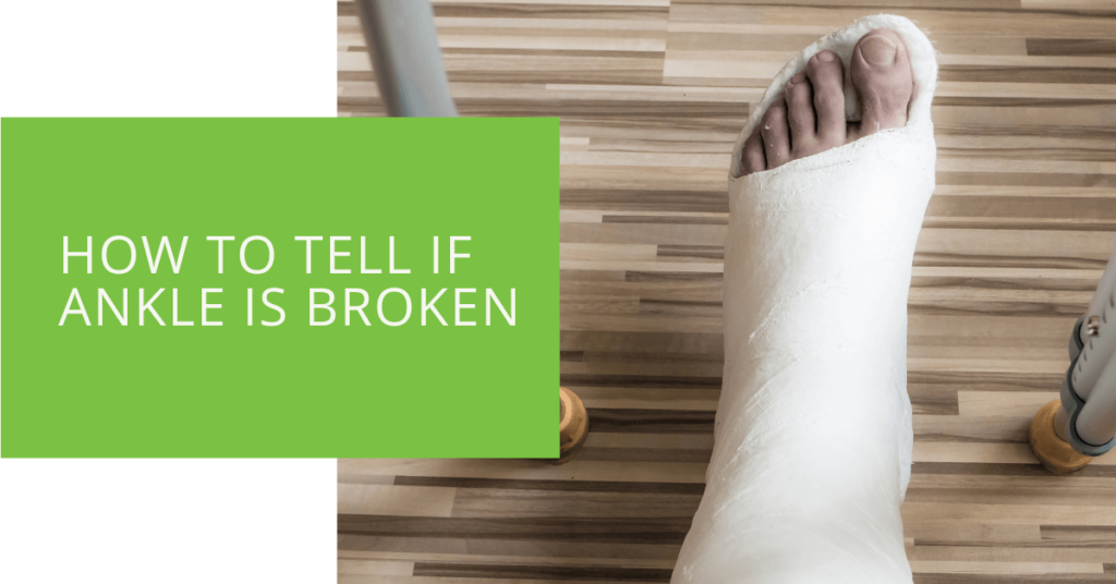 How to Tell if Ankle is Broken
