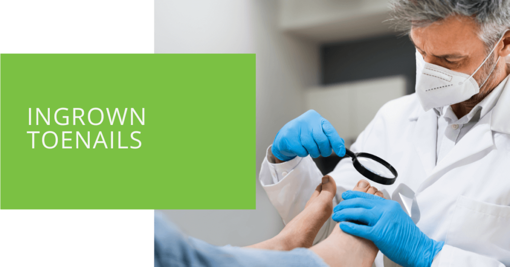 Ingrown Toenails