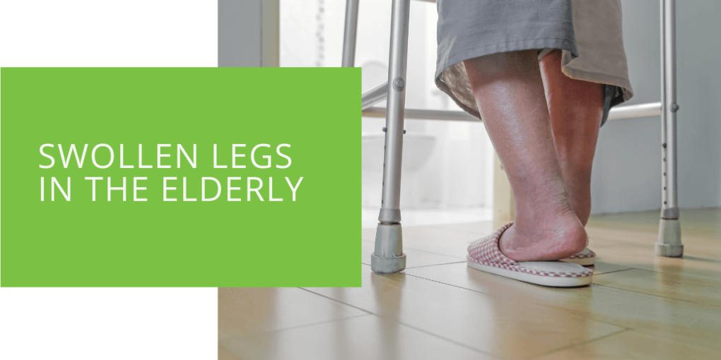 Swollen Legs in the Elderly
