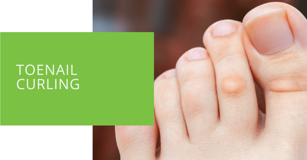 Toenail Curling