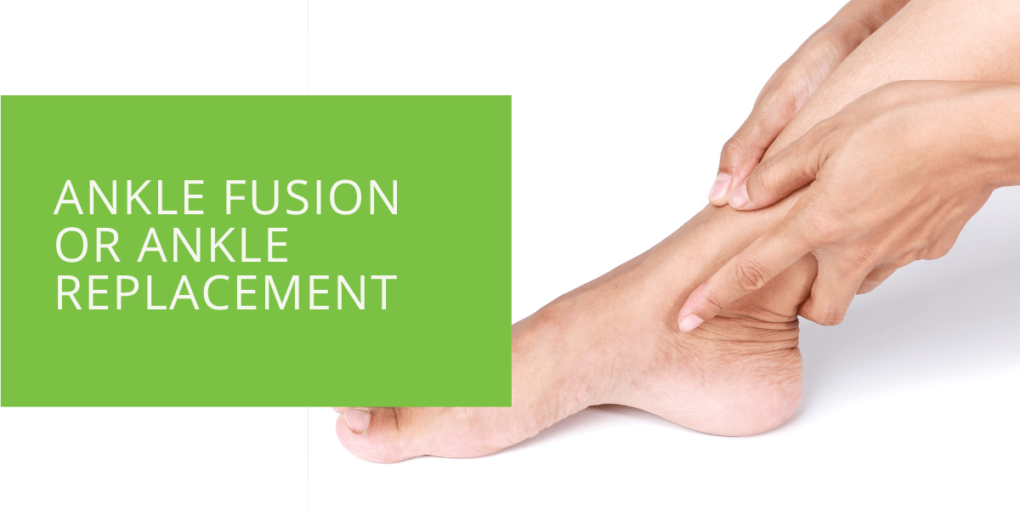 Ankle Fusion or Ankle Replacement