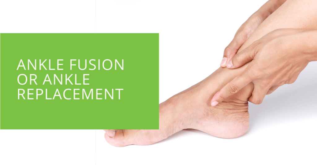 Ankle Fusion or Ankle Replacement