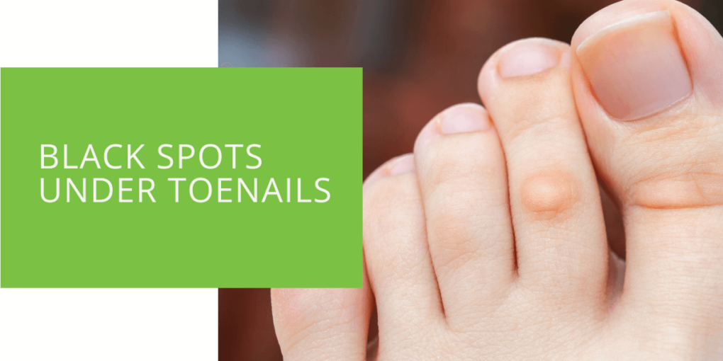 Black Spots Under Toenails