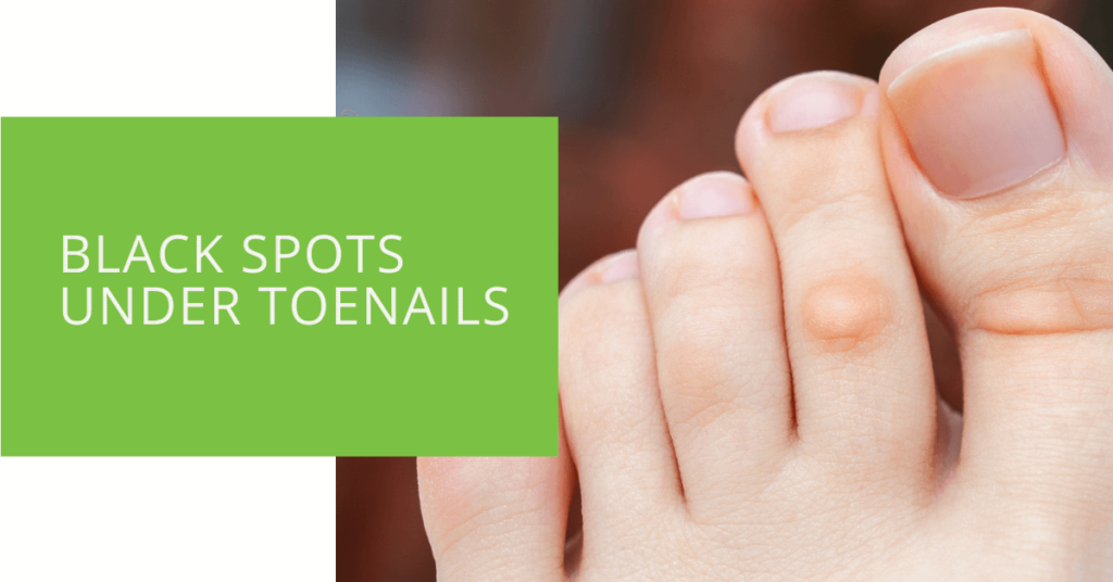 Black Spots Under Toenails