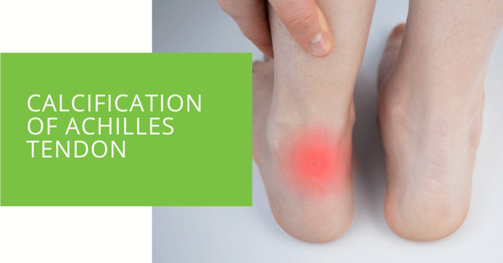 Calcification of Achilles Tendon