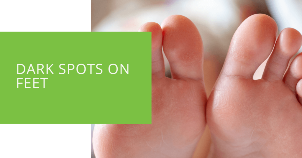 Dark Spots on Feet